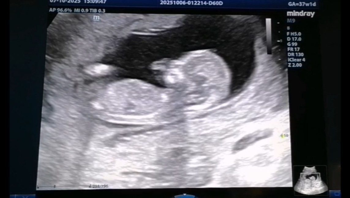 В Перинатальном центре Йошкар-Олы в отделении лучевой диагностики работает 7 врачей