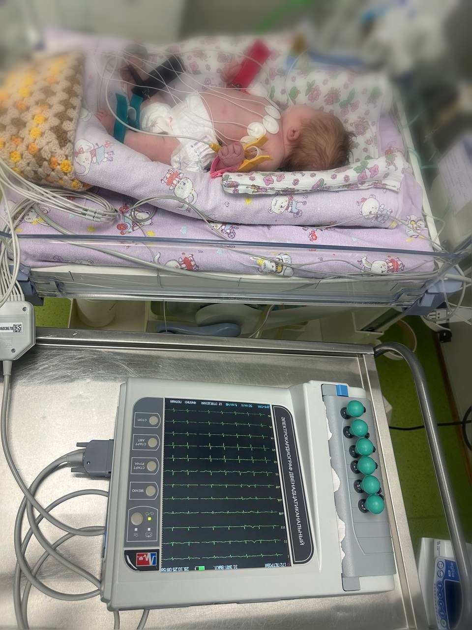 В Перинатальном центре Йошкар-Олы начал функционировать новый 12-канальный ЭКГ аппарат В Перинатальном центре Йошкар-Олы начал функционировать новый 12-канальный ЭКГ аппарат