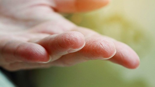 ��� ������� ����� �������� �� ��������� ���: ����������� ������ �� �������