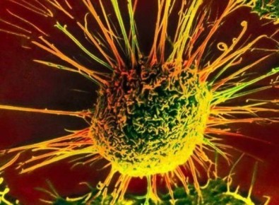 Рак в мировом контексте: как западный образ жизни влияет на заболеваемость